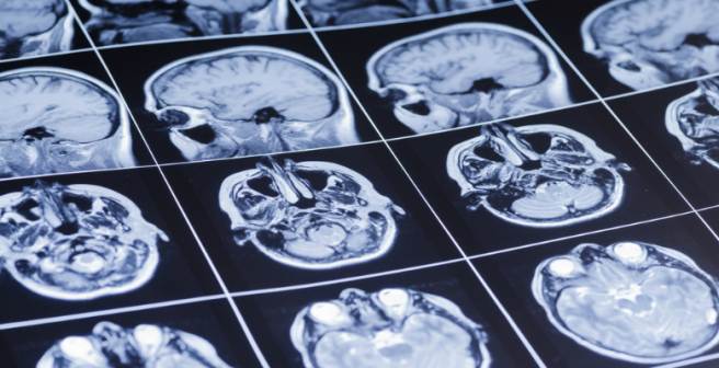2014 Nobel Prize for Physiology/Medicine awarded to the discovery of ‘place cells’ in brain