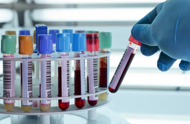 A new way of detecting cancer through RNA test of blood platelets discovered