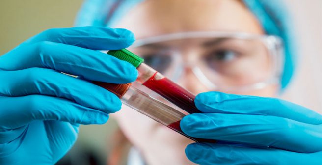 CRISPR/Cas9 method removes HIV from human cells