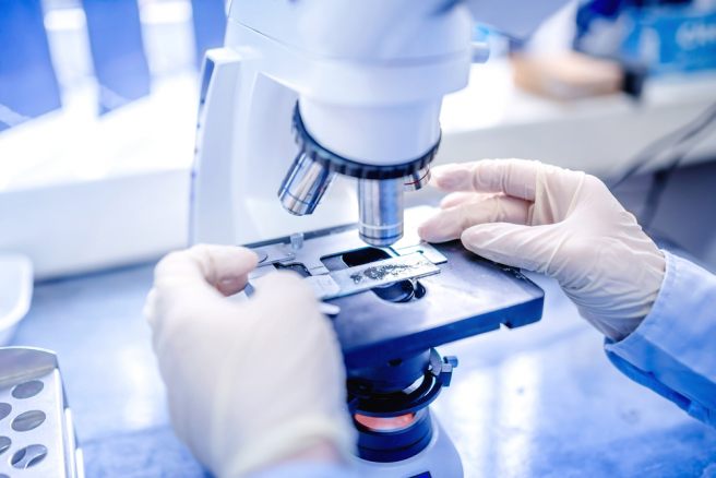 Cause of fragile X sysndrome uncovered