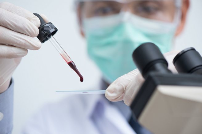 Induced pluripotent stem cell treatment set for its first human trial