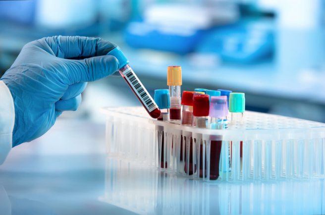 Germs could trigger type-1 diabetes