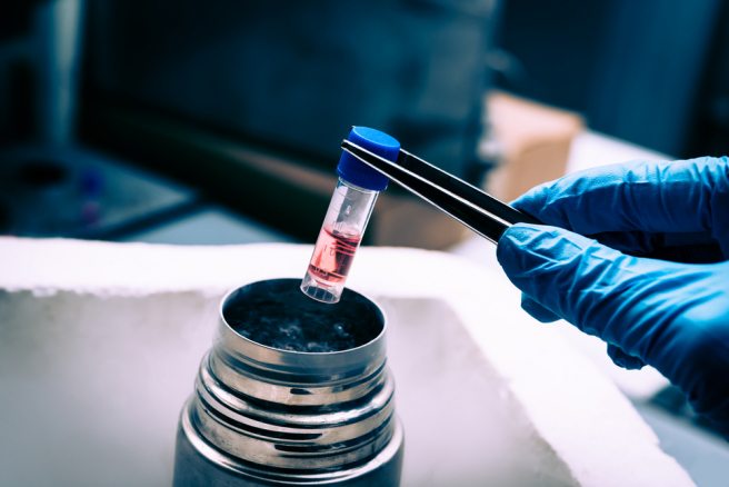 Researchers discover that stem cell growth can be controlled using beams of light