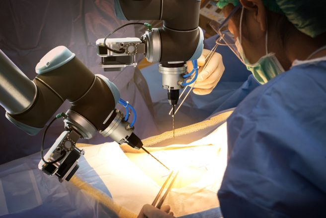 Soft robotic arm: An option to standard endoscopes