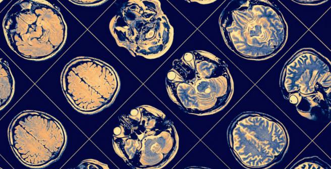 The brain can detect diseases in others using different senses