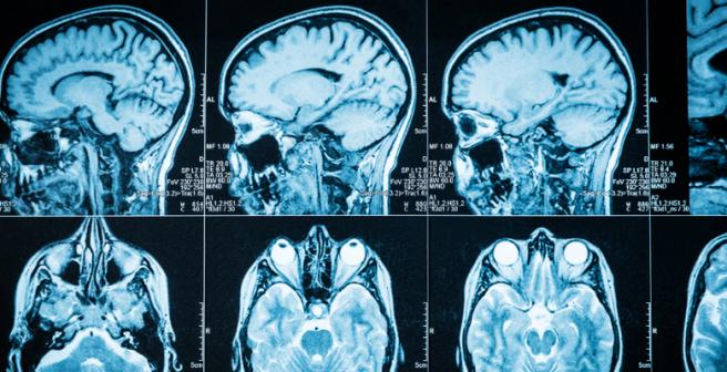 The first learned language influences the way brain processes other languages