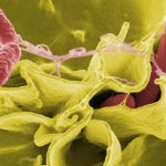 Newly discovered mechanism of gene regulation underlies bacterial virulence