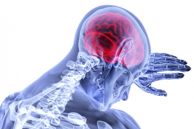 “Normal” MRI scan accompanied by dizziness—warning sign of posterior stroke