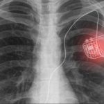 A Novel Active Photonic Wireless System to Power Medical Implants