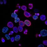 Newly synthesized fungal compound can switch on a self-destruct button for cancer