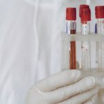 A micro-lab on a chip detects blood type within minutes