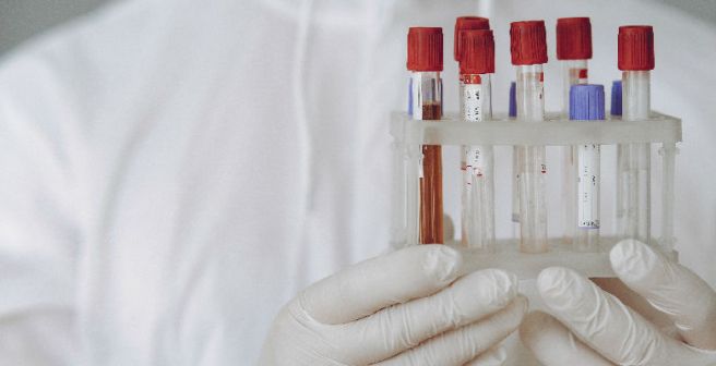 A micro-lab on a chip detects blood type within minutes