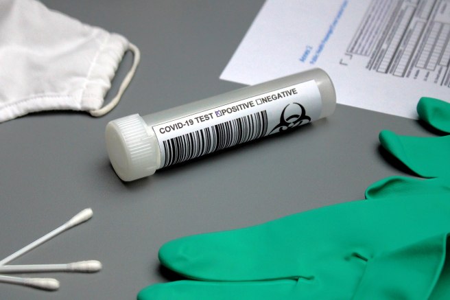Diagnostic tests for COVID-19 (rT-PCR, chest CT, ELISA)