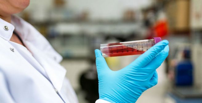 Down to the bone: Understanding how bone-dissolving cells are generated